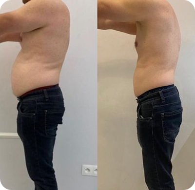 The Transformation